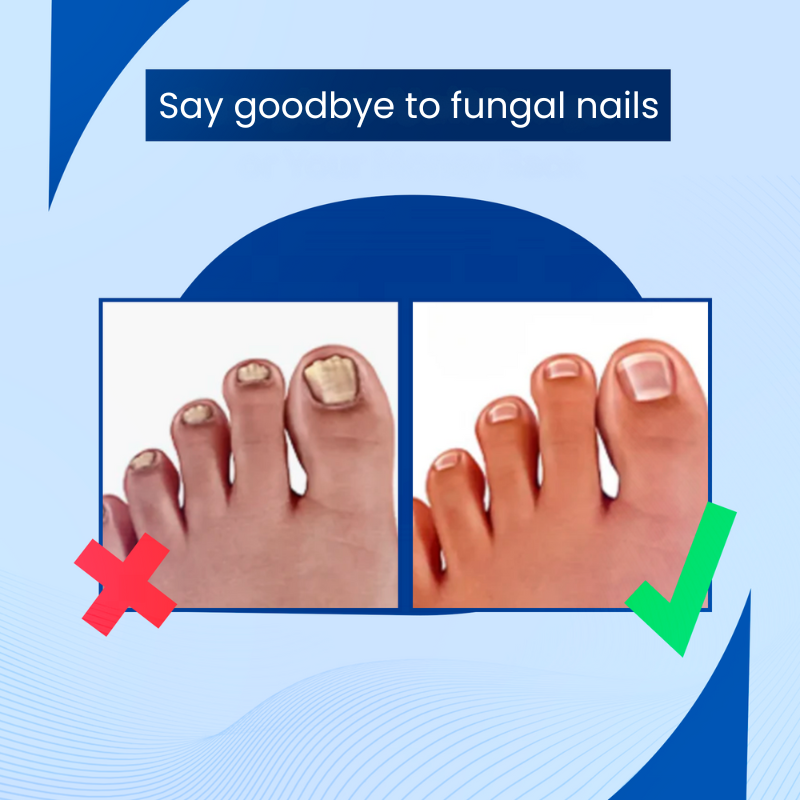 DermalPulse™ - Effective Treatment for Fungal Nails