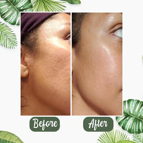 Green Tea Deep Cleansing Mask