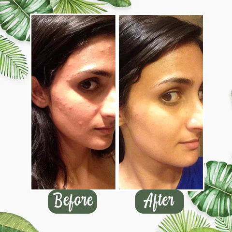 Green Tea Deep Cleansing Mask